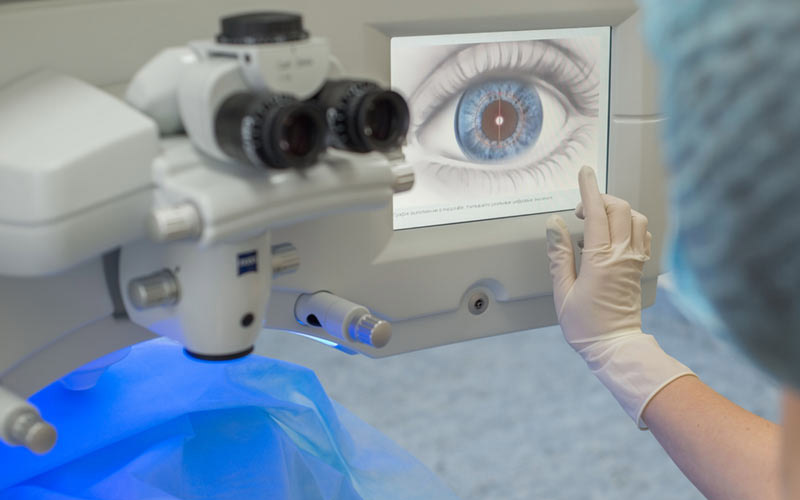 10 Cataract Surgery Side Effects, and How to Cope